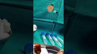 Epic Surgery Milestone: Dr. Morton's Ether Anesthesia Triumph || History #history