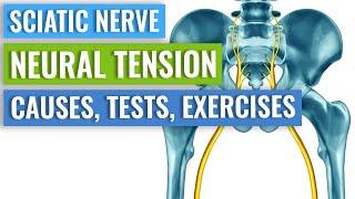 Eight Exercises to Relieve Sciatic Nerve Tension