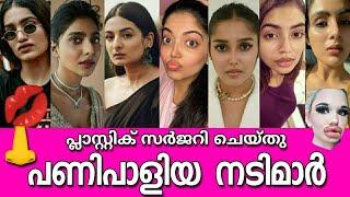 പ്ലാസ്റ്റിക് സർജറി ചെയ്ത്‌ പണി പാളിയ മലയാള നടിമാർREAL PLASTIC SURGERY in Malayalam Film Industry