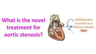 What is the novel treatment for aortic stenosis?