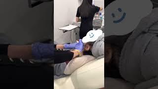 Profhilo Treatment for Neck