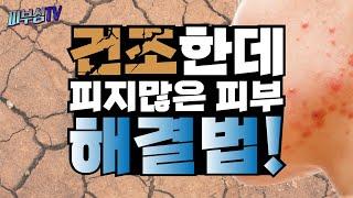 피부는 건조한데 피지가 많은 피부 타입 해결법! [피부과전문의 피부심]