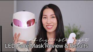 I Tried LumiVisage LED Face Mask | 6-week update | Chris Han