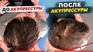 Акупрессура подзатылочных мышц – До/После. Отзывы после процедуры у Константина Гражданкина