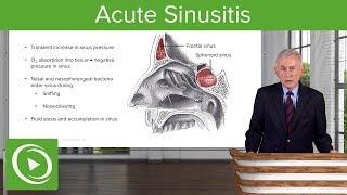 Acute Sinusitis – Infectious Diseases | Lecturio