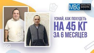 Минус 45 кг за 6 месяцев | Отзыв после шунтирование желудка