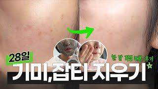 기미,잡티 없애기 챌린지! 한 달간 도전해 보았습니다! (#기미없애는법 #피부하얘지는법)