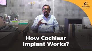 How Cochlear Implant Works? | Cochlear Sri Lanka | Wickramarachchi Hearing Care | Hearing Health