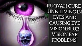 RUQYAH CURE : JINN LIVING IN EYES, EYE VISION,BLUR VISION,EYE PROBLEMS DUE TO BLACK MAGIC,JINN