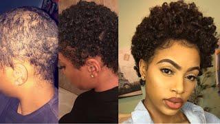 Big Chop Q & A: Hair Growth Pills, Protective Styles and Texturizers?