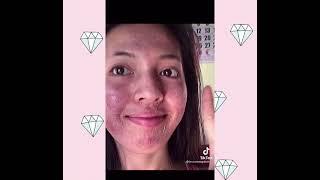 BINABASH NIYO NOON ETO NA NGAYON | BRILLIANT SKIN ESSENTIALS | TRANSFORMATION