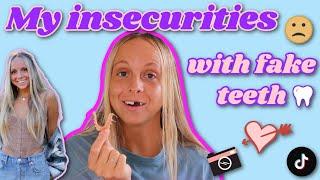 My Insecurities with Fake Teeth | LILY MAGNO