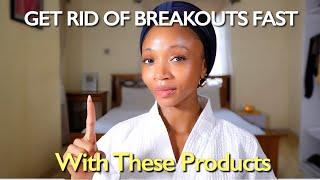 The Best Products For Acne Prevention | Get Rid of Breakouts Fast