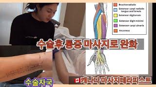 수술후 마사지 치료 방법 꿀팁 아무도 알려주지 않은 수술후 마사지법 알려드릴게요  Acute/Subacute post surgery massage treatment RMT