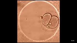 Развитие эмбриона с момента оплодотворения in vitro и до 5-6 дня развития (реальное видео)