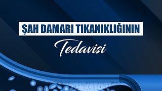 Şah Damar Tıkanıklığı Tedavisi - Prof. Dr. Şevket Görgülü