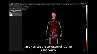 Dynamic PET/CT data from the Siemens Quadra in Hermia software.