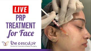 PRP Treatment For Face - How Is It Done? | The Aesculpir | Best Cosmetic Treatments in Delhi