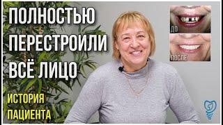 Полностью перестроили всё лицо. Имплантация зубов. История пациента.