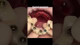 Dental Health Care | Dr. Wasif Rashid | Dentist | #foryou #shorts