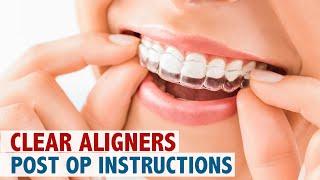 Clear Aligners Post Op Instructions