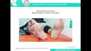 estrategias de prevención del pie diabético CHUCO