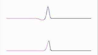 Propagation of a pulse in a string