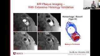 2022 June Grand Rounds - Chun Yuan, PhD