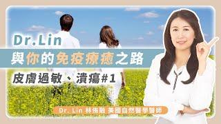 Dr.Lin與你的免疫療癒之路-皮膚過敏潰瘍#1 | Dr. Lin 林侑融 自然醫學醫師 Ep59