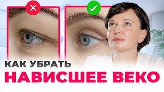 Нависшее веко. Как убрать нависшее веко без хирургической операции | Ирина Рахова