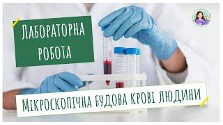 Лабораторна робота. Мікроскопічна будова крові людини