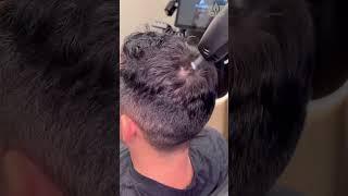 TED Hair Restoration