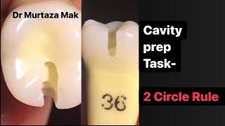 2 Circle Rule- ADC Cavity Preparation Task