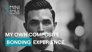 Dentist Simon Chard's own composite bonding experience