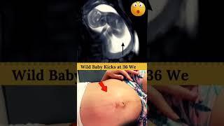 baby kick in mother womb #baby #movement