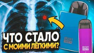 ЧТО СТАЛО С МОИМИ ЛЁГКИМИ ПОСЛЕ 5 ЛЕТ ПАРЕНИЯ ВЕЙПА?