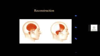 Tumors of the Temporal Bone