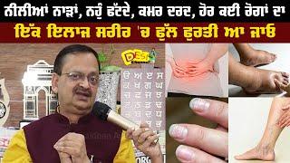 Swelling Problem | Varicose Veins Problem | White Spot on Nails | Back Pain | Subhash Goyal