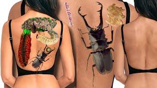 ASMR Big Acne & Maggot Infested Face Removal | Severely Injured Animation |back Magoot remov|