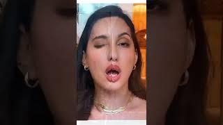 Nora Fatehi has gone through all these Plastic SURGERIES |#trending #viral