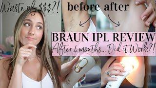 BRAUN IPL REVIEW//DID IT WORK?!//4 months later...//Hair Removal Review & Tutorial