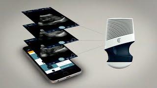 Clarius: Revolutionary Wireless Ultrasound Scanner