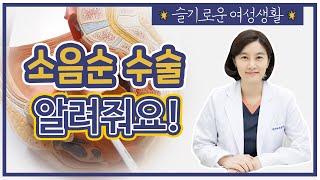 여성성형의 대세!! 여성전문의가 알려주는 여성 소음순 수술