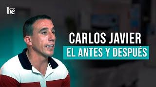  La Transformación de Javier: Resultados Impresionantes de Injerto Capilar | Clínicas Be 