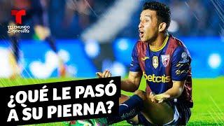 Christian “Hobbit” Bermúdez sufre una horrible lesión en México | Telemundo Deportes