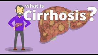 Cirrhosis - What is cirrhosis?