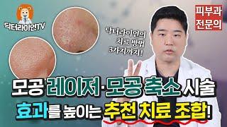 [모공 정복 2탄] 모공 레이저·코 모공 흉터 시술 시 효과를 높이는 최고의 추천 치료 조합!