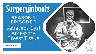 Season 1 Episode1:  Sebaceous Cyst and Accessory Breast Tissue