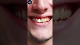 permanent teeth वापस regrow होंगे जानिए kaise ? #shorts #trending #teeth #regrow #facts #viral