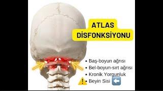 AKLIMDAKİ KİŞİ • BEYİN SİSİ‍